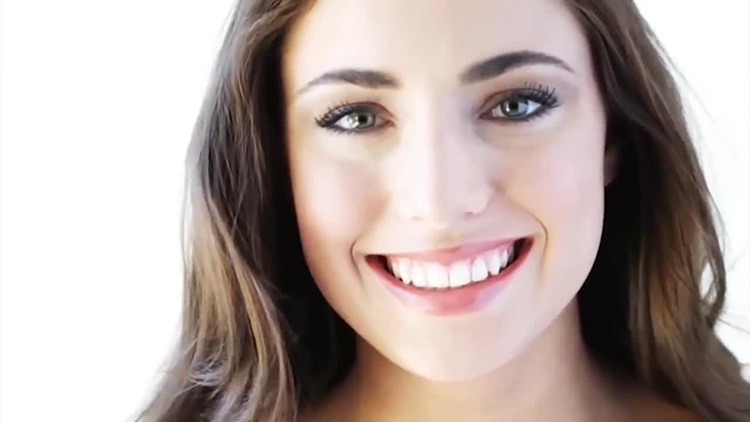 KROON OP IMPLANTAAT ANTWERPEN  DENTAL CARE CLINIC BRASSCHAAT BELGIE